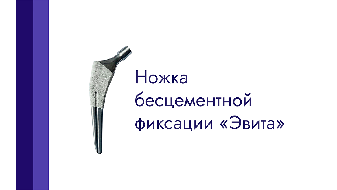 Компания «ЭндоАрт» запускает серийное производство титановой ножки бесцементной фиксации «Эвита»